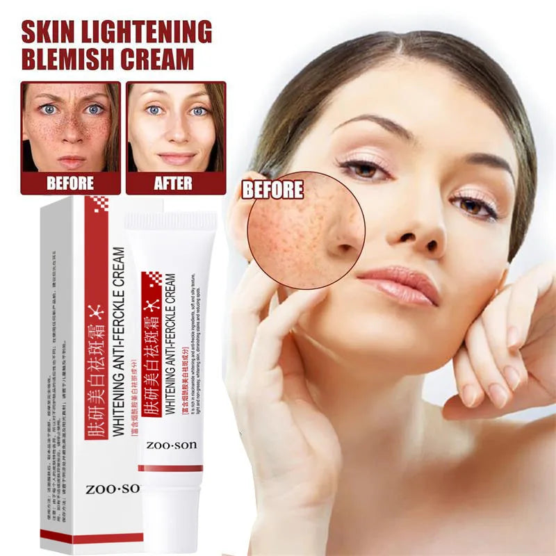 Brightening Dark Spot & Freckle Face Cream – Niacinamide Brightening Face Cream Qme