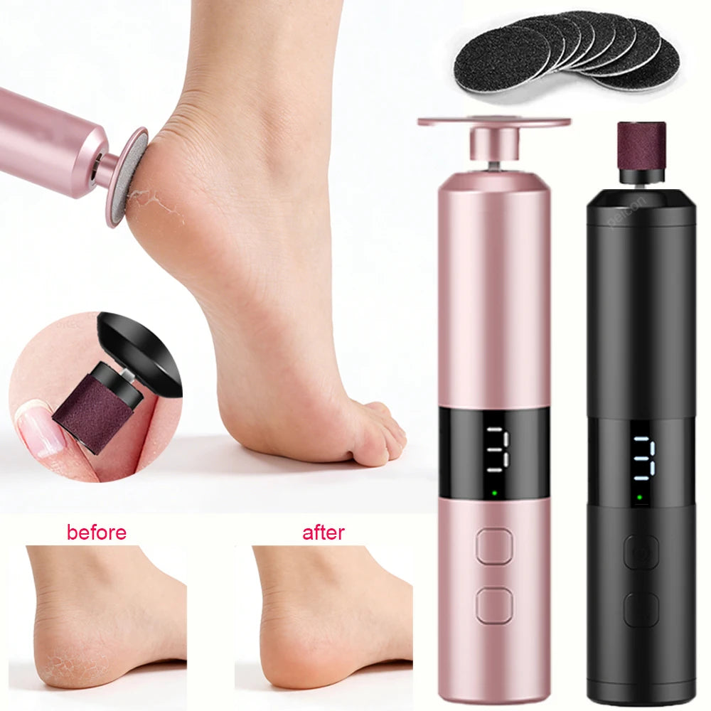 Electric Foot Callus Remover Rechargeable – bcomfy Feet File Electric Callus Remover Qst