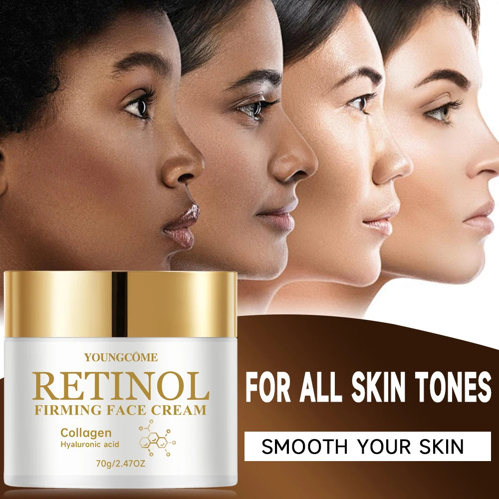 YOUNGCOME Retinol Firming Face Cream Anti-Aging Moisturiser Retinol Face Cream Qst