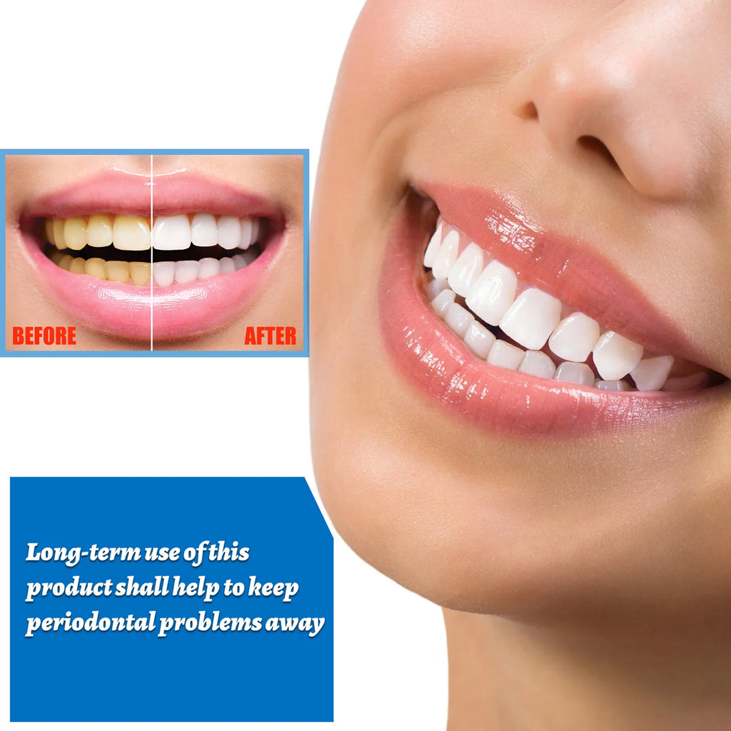EELHOE Teeth Whitening Serum – Plaque & Stain Remover 10ml Teeth Whitening Serum Qst