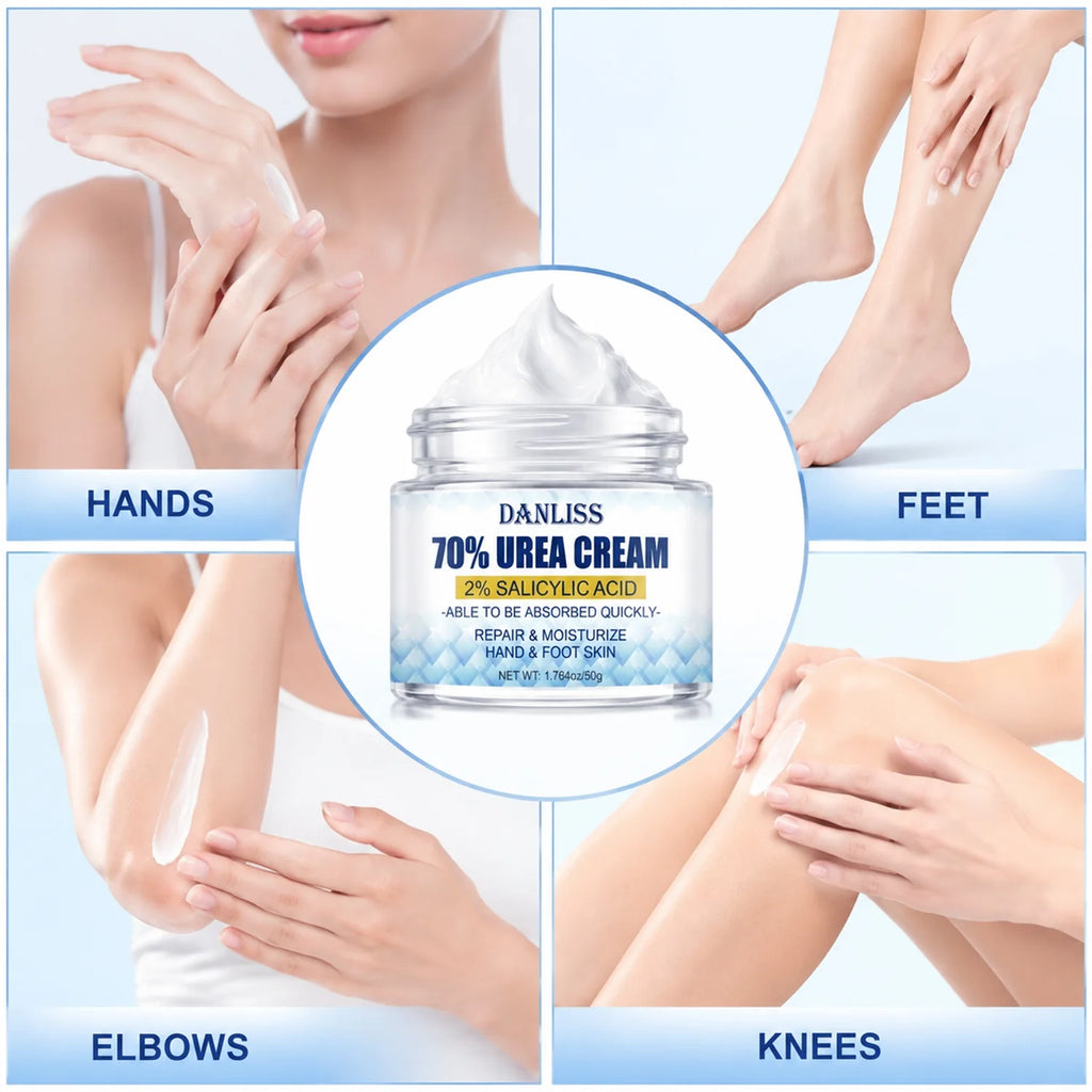 Lanemay 70% Urea Cream 2% Salicylic Acid – Feet & Hands 50g Foot & Hand Cream Qst