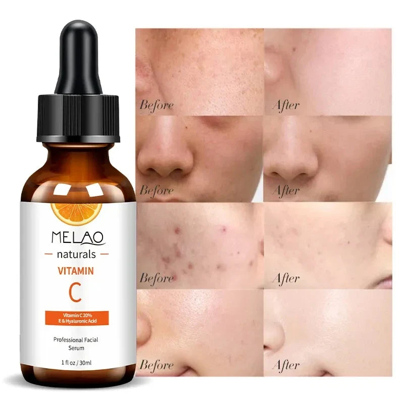 MELAO Vitamin C Serum 20% – Hyaluronic Acid & Vitamin E Vitamin C Face Serum Qme