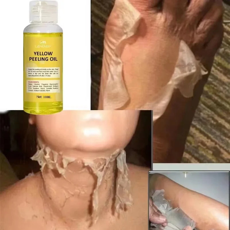 Brightening Peeling Oil Body Lotion – Exfoliate & Even Skin Tone Exfoliating Body Lotion Qme