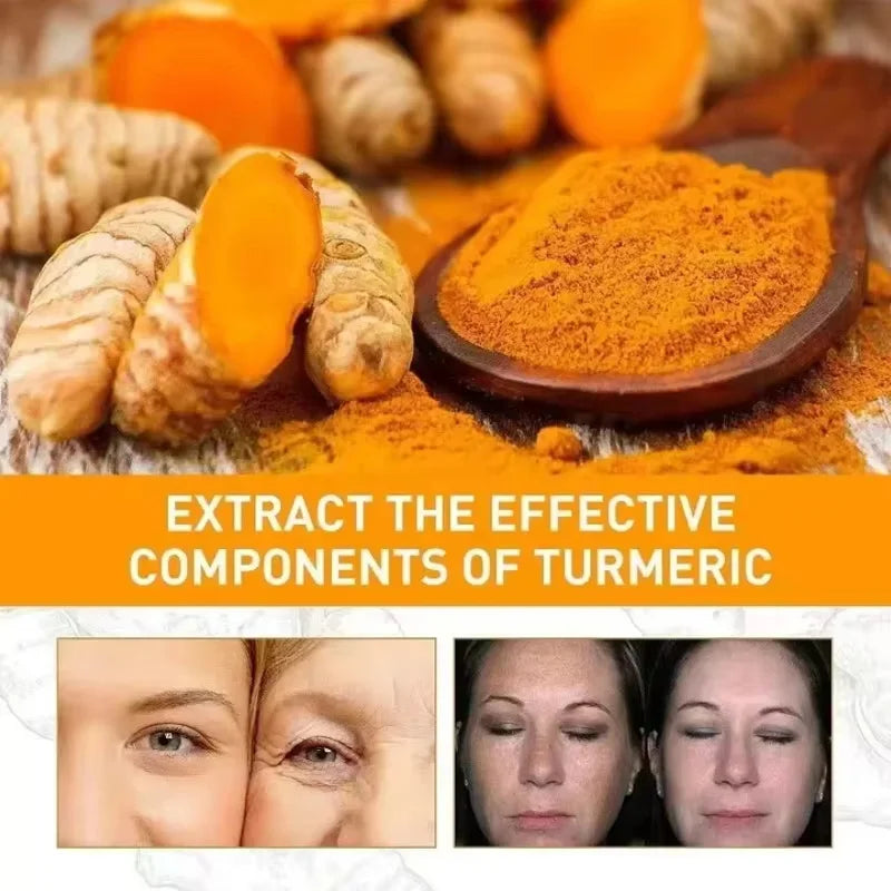 Turmeric Repair Essence – Brightens Dark Spots & Moisturizes Brightening Face Serum Qme