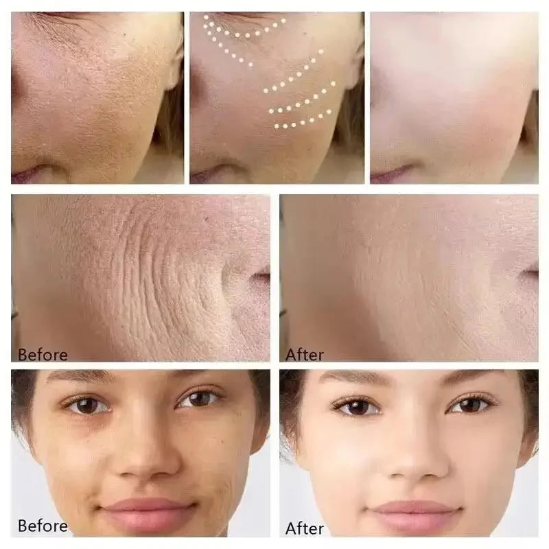 Retinol Face Cream – Firming, Lifting & Fine Line Smoothing Retinol Face Cream Qme