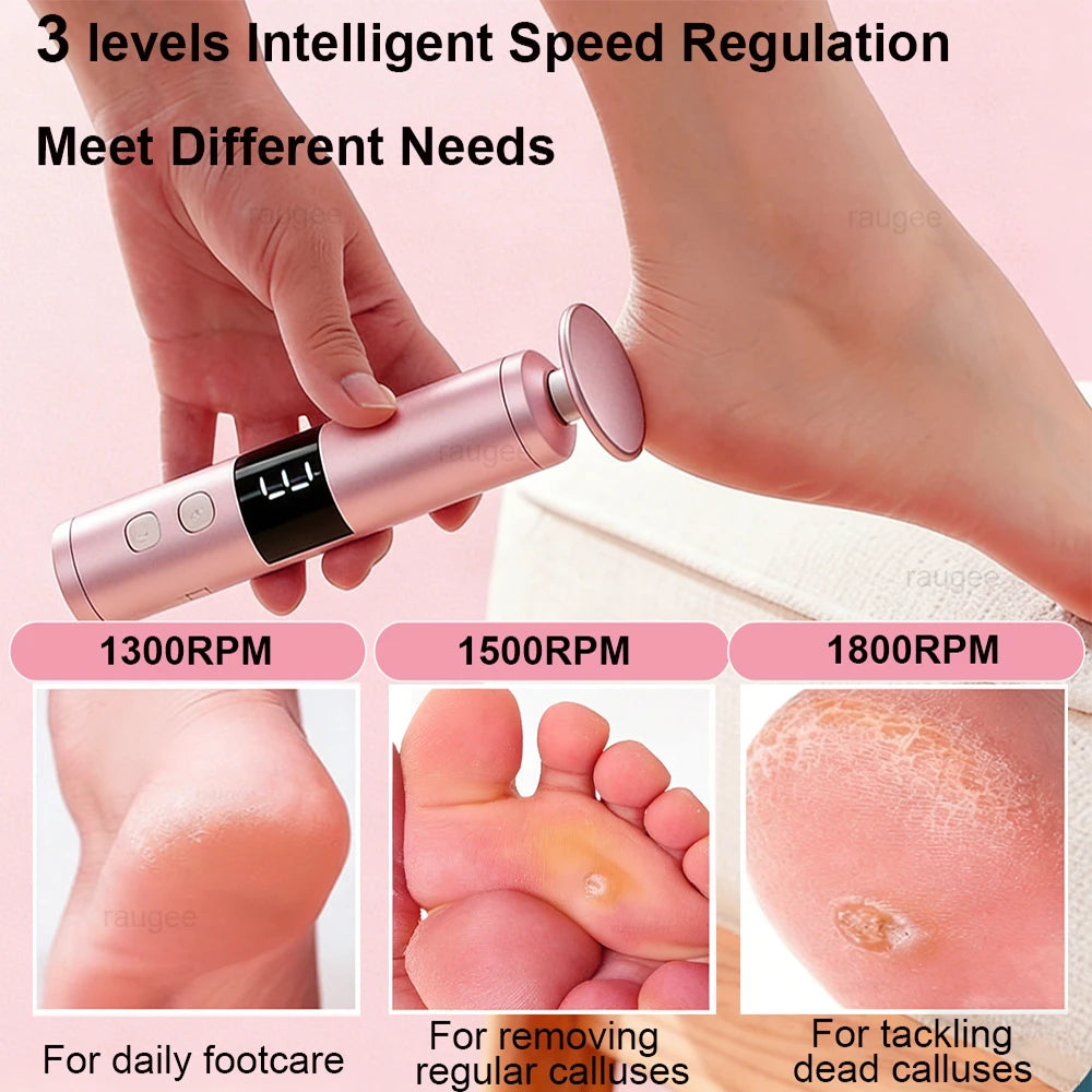 Electric Foot Callus Remover Rechargeable – bcomfy Feet File Electric Callus Remover Qst