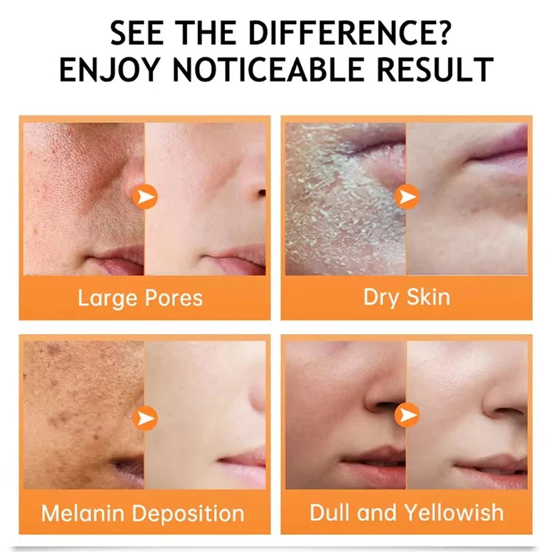 Turmeric Repair Essence – Brightens Dark Spots & Moisturizes Brightening Face Serum Qme