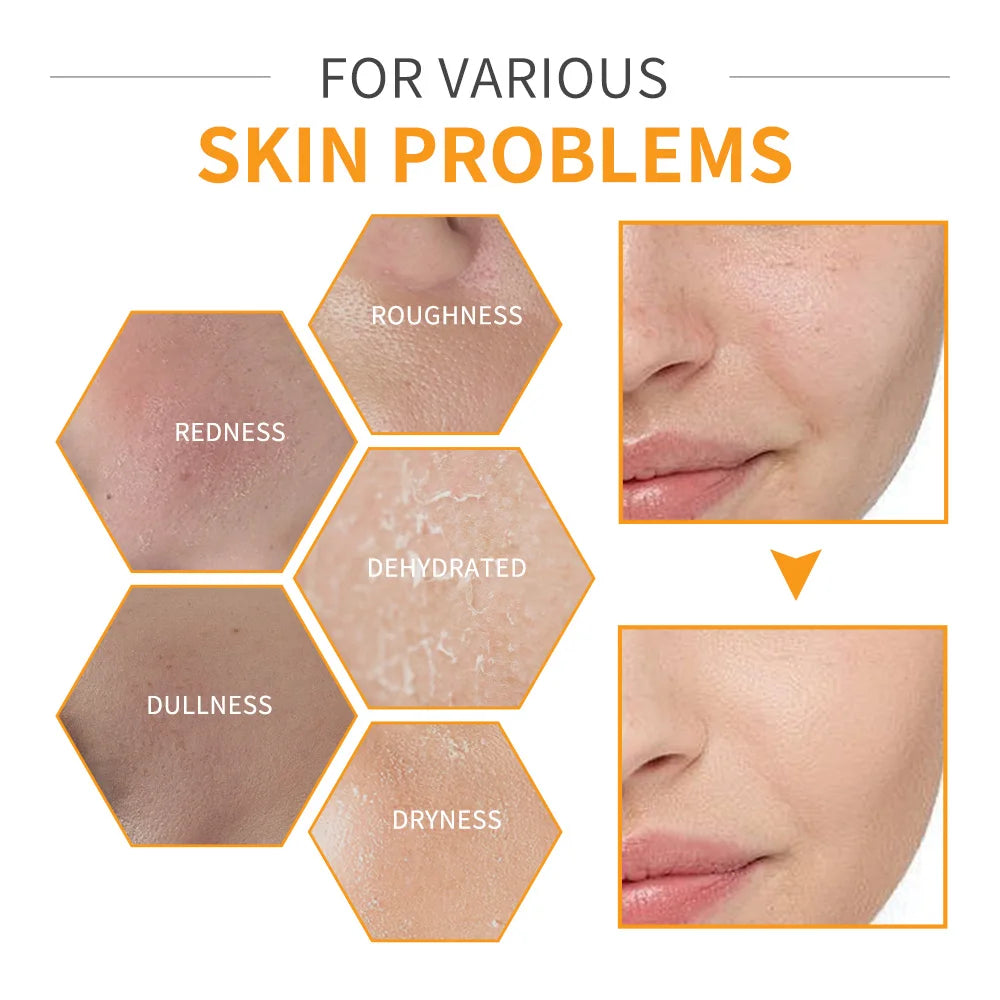 Lakerain Vitamin C Hydrating Toner – Natural Moisturizing Vitamin C Toner Qst