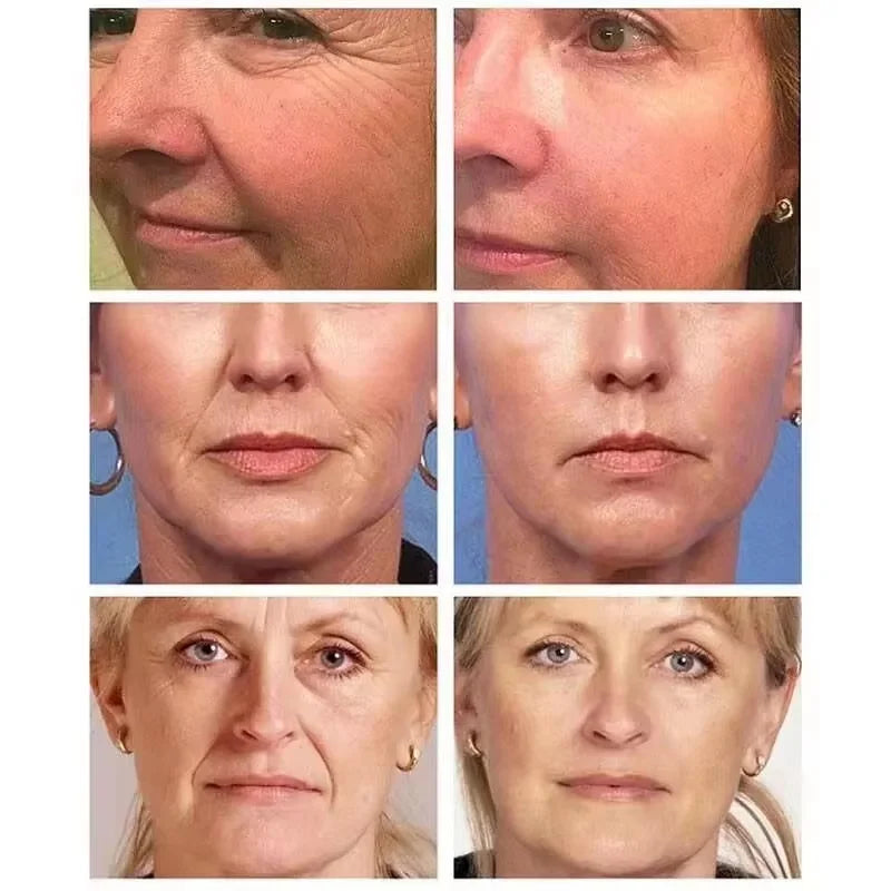 Retinol Anti-Aging Face Cream – Firming, Lifting & Brightening Anti-Aging Face Cream Qme