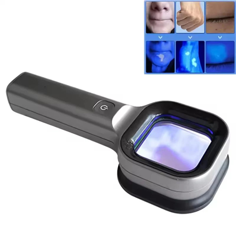 Wood's Lamp UV Skin Analyzer – Portable 365nm Beauty Tool UV Skin Analyzer Qst
