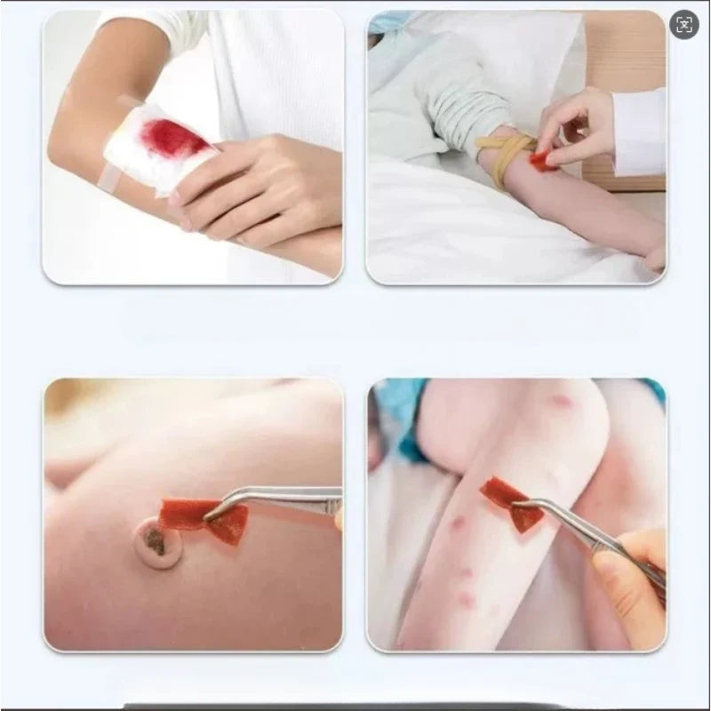 Portable Iodine Skin Disinfection Solution | Outdoor First Aid Skin Antiseptic Solution Qme