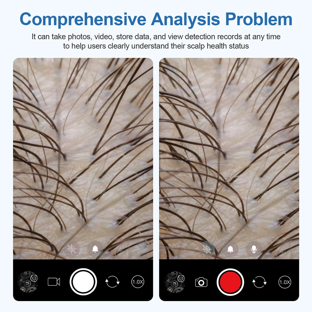 Scalp & Hair Follicle Analyzer – 4X HD Pore Skin Detector Scalp Skin Analyzer Qst