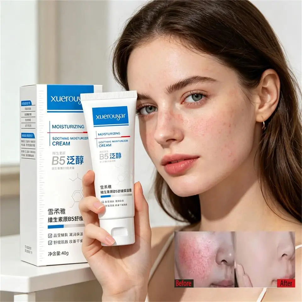 B5 Facial Redness Balancing Cream for Sensitive Skin | Qme Facial Redness Cream Qme