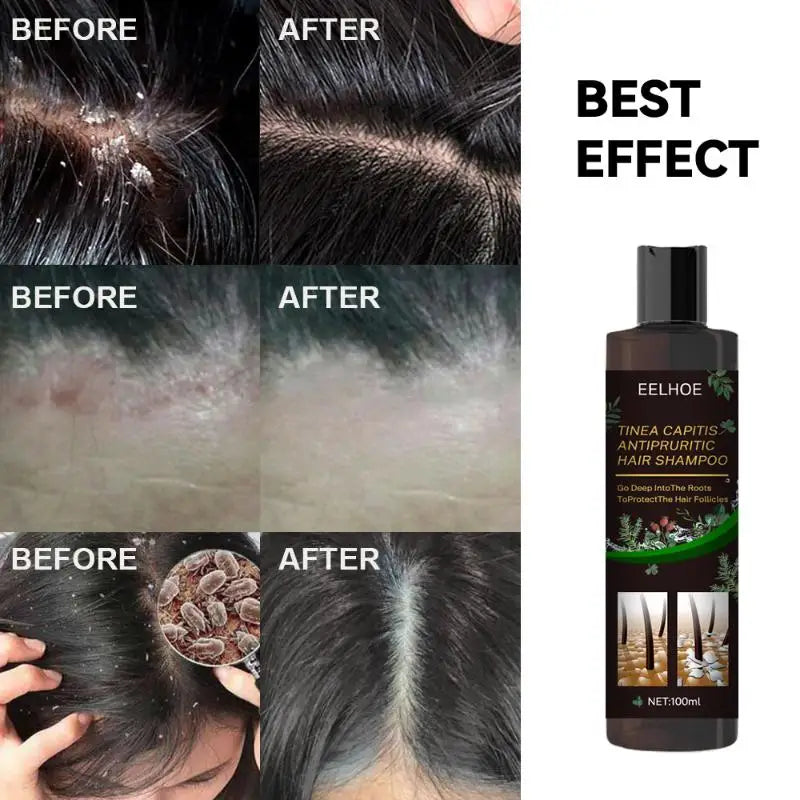 Herbal Deep Moisturizing Nourishing Scalp Shampoo 100ml Herbal Hair Shampoo Qme