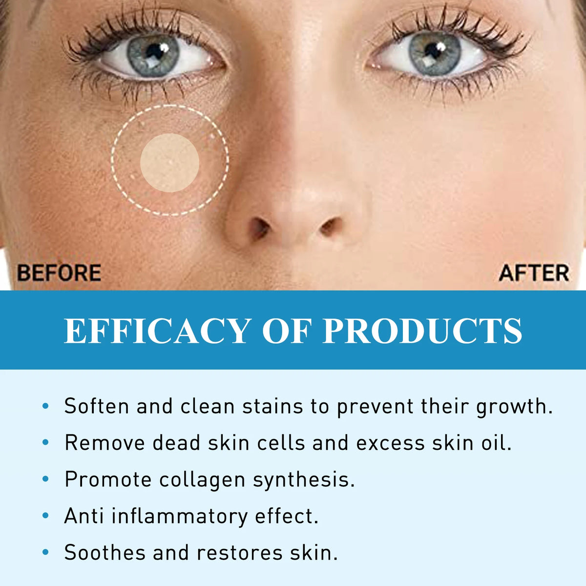 South Moon 144pcs Hydrocolloid Blemish Patches | Salicylic Acid Blemish Patch Qst
