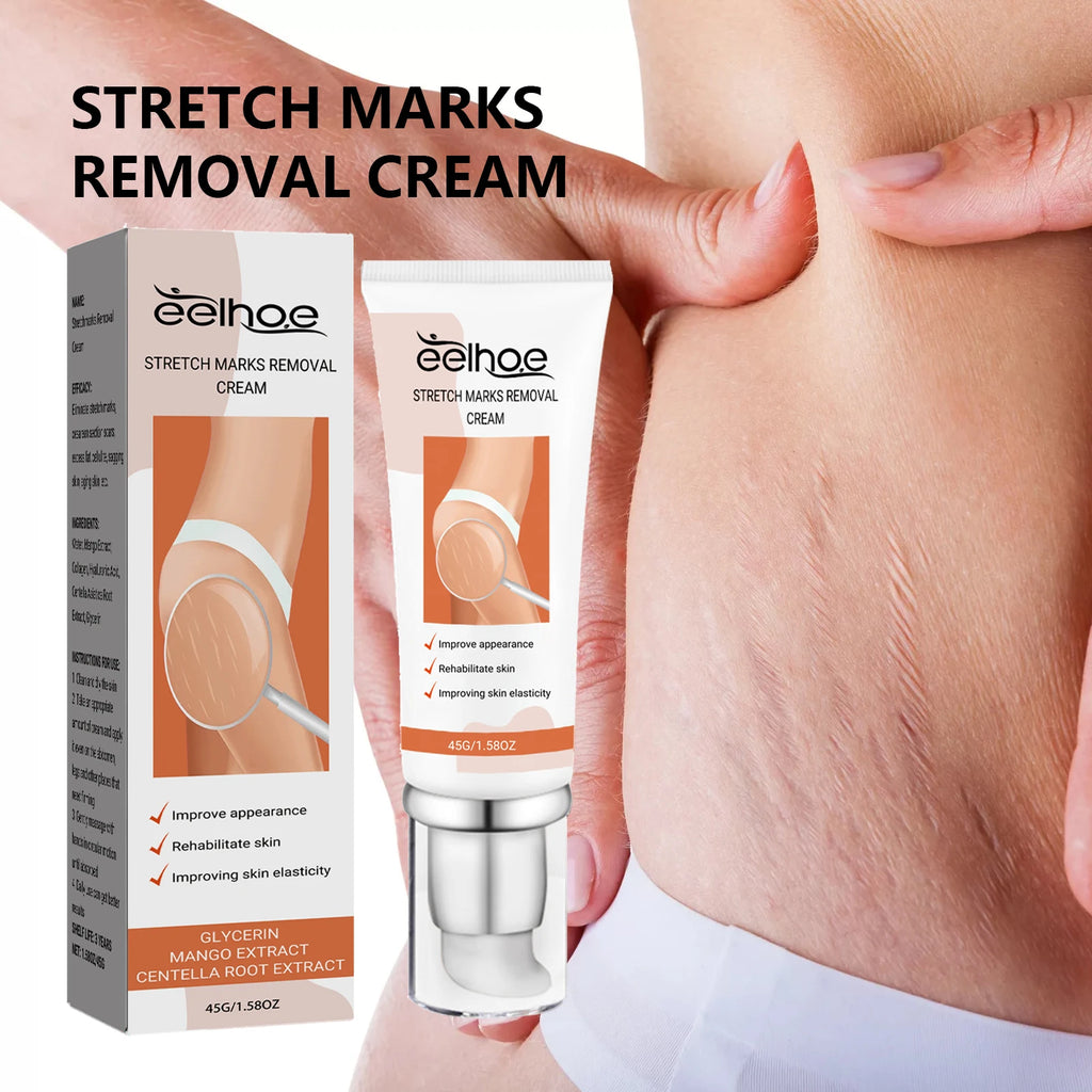 EELHOE Stretch Mark Cream – Firm, Smooth & Brighten Skin 45g Body Care Cream Qst