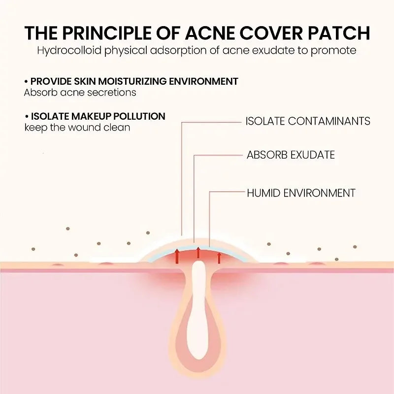 LGRAMER 200pcs Acne Pimple Patch – Blemish Cover Skin Care Acne Pimple Patch Qst