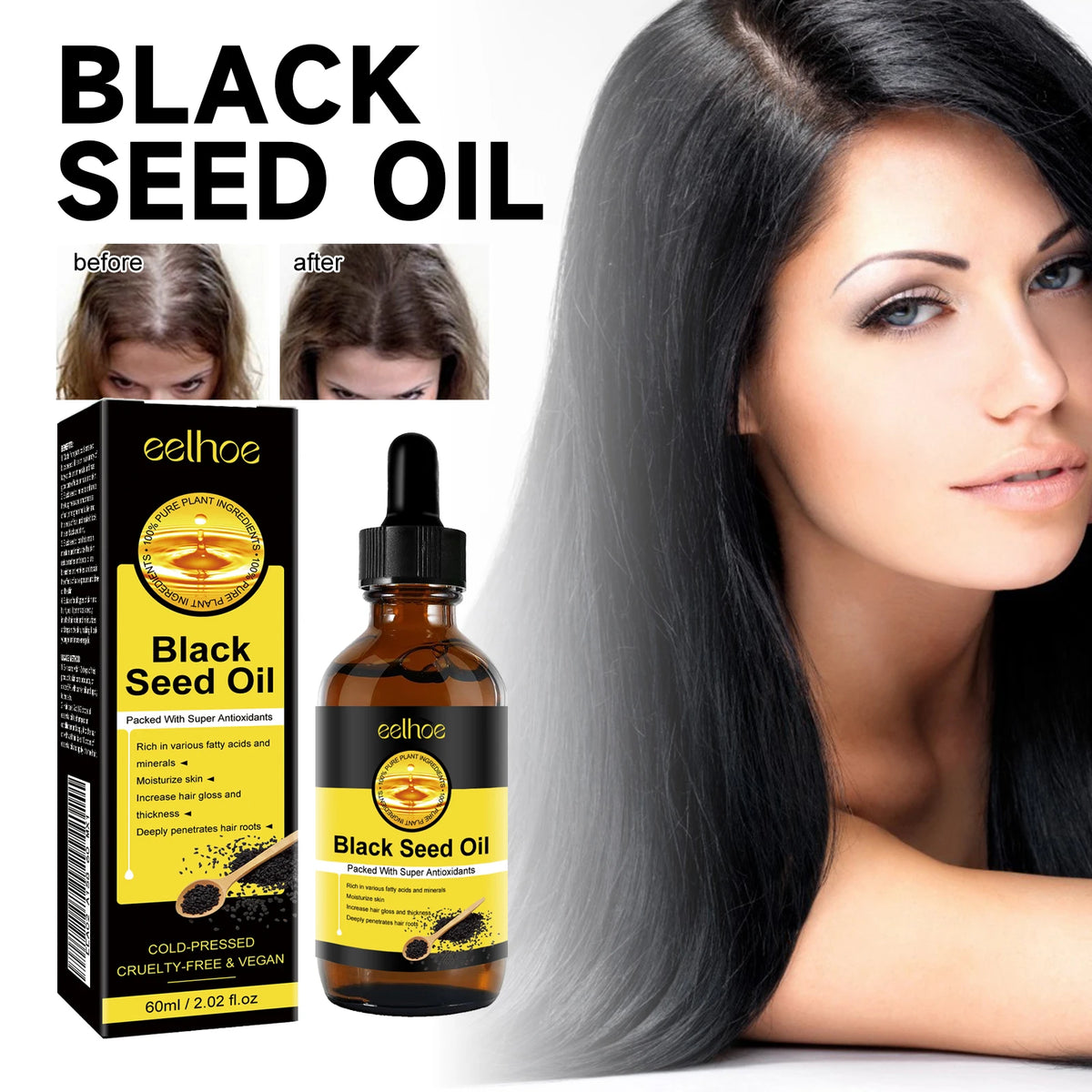 Eelhoe Hair Growth Essential Oil – Fuller, Thicker Hair Hair Growth Oil Qst