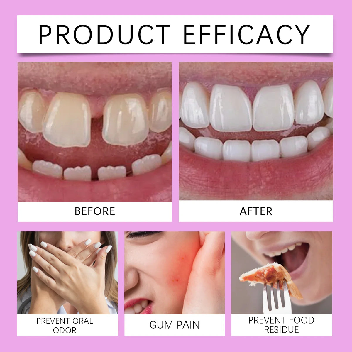 Oralhoe Denture Adhesive Cream – Strong Hold False Teeth Glue Denture Adhesive Cream Qme