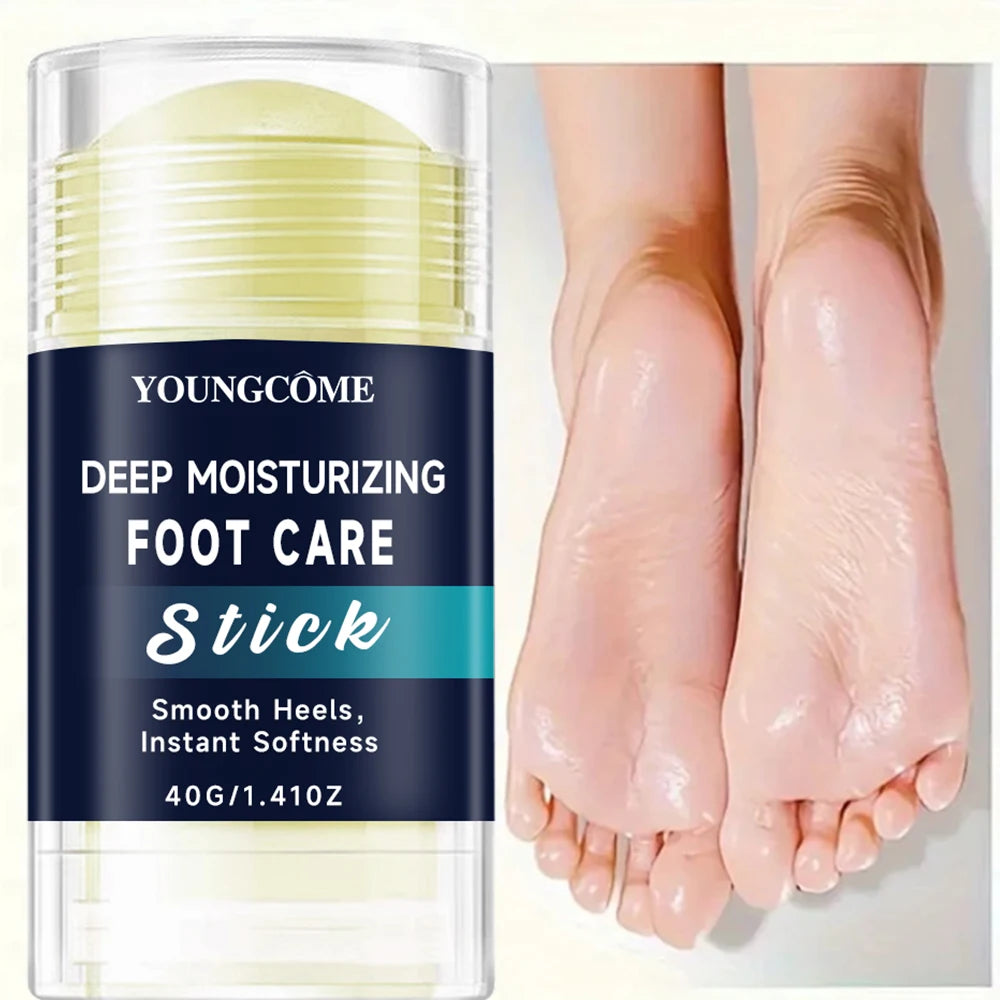 YOUNGCOME Deep Moisturizing Foot Cream – Nourishing & Smoothing Foot Care Cream Qst