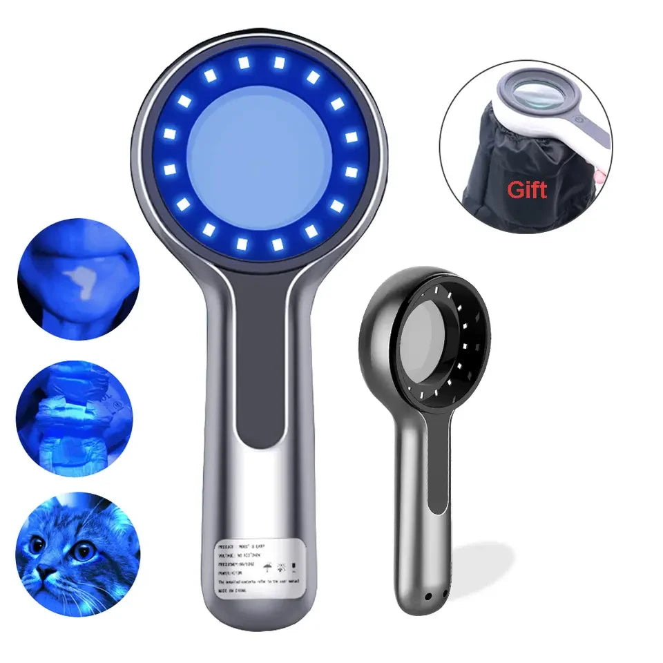 Woods Lamp UV Skin Analyzer – Vilnason DW-B200 Facial Tool UV Skin Analyzer Qst