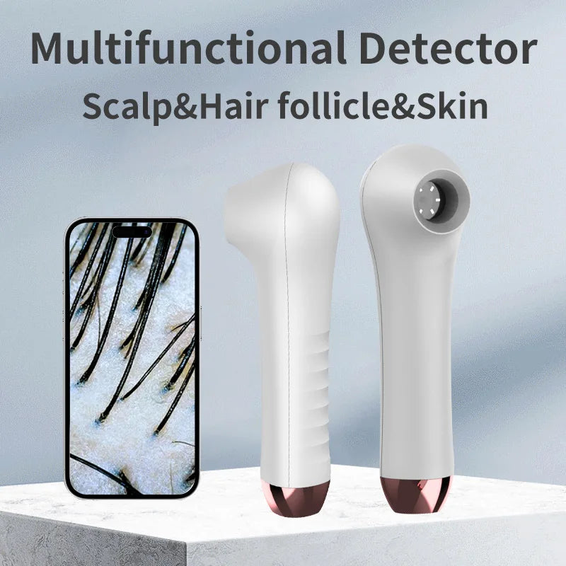 HD Scalp & Hair Follicle Analyzer – OTG Skin Magnifier Scalp Skin Analyzer Qst