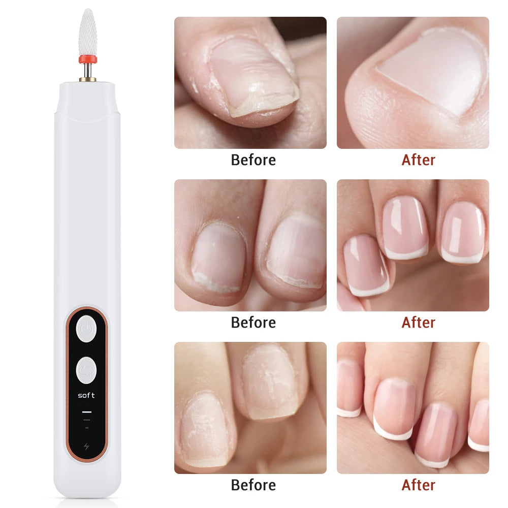 VIMYSHOW 6-in-1 Cordless Electric Nail Drill & Manicure Kit Electric Nail Drill Qst
