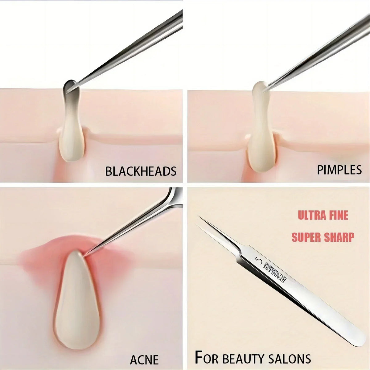 Precision Blackhead & Whitehead Removal Tweezers | Qme Facial Removal Tool Qme