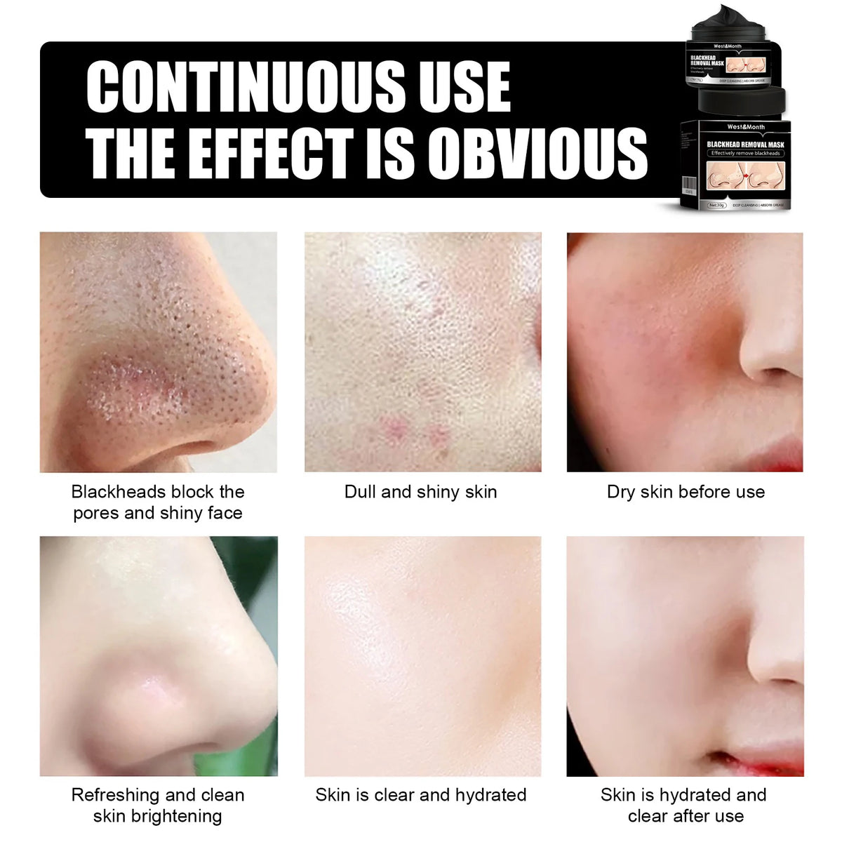 Activated Carbon Peel-Off Blackhead Mask – All Skin Types Peel-Off Face Mask Qst