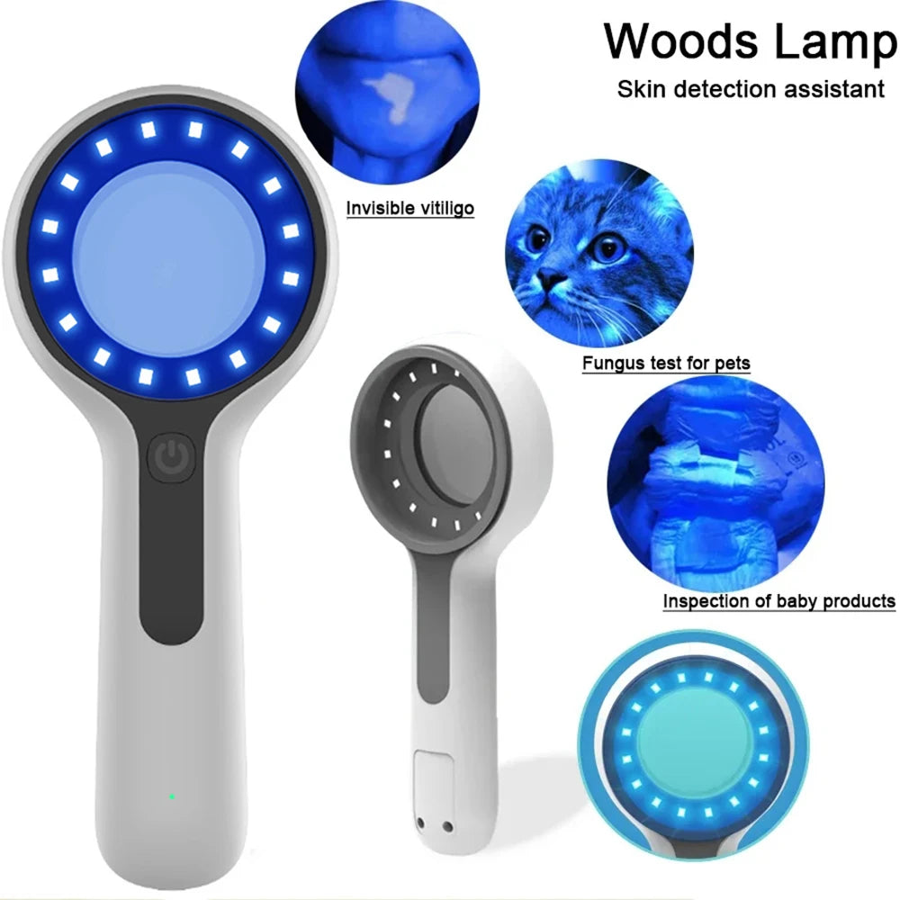 Woods Lamp Skin Analyzer – UV Magnifying Facial Beauty Tool Skin Analysis Lamp Qst