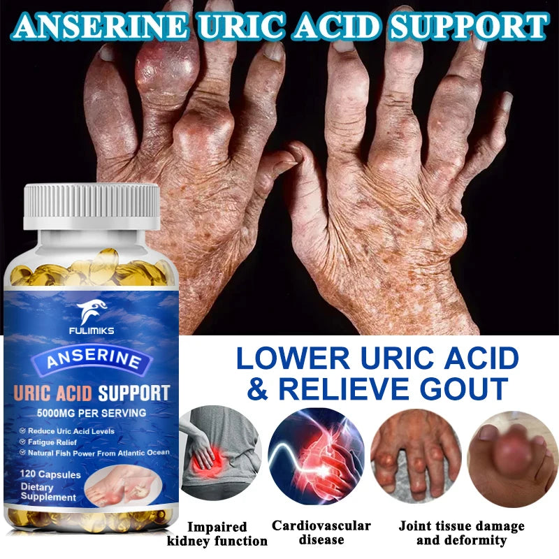Uric Acid Support Capsules – Tart Cherry, Milk Thistle & Dandelion Herbal Supplement Qst