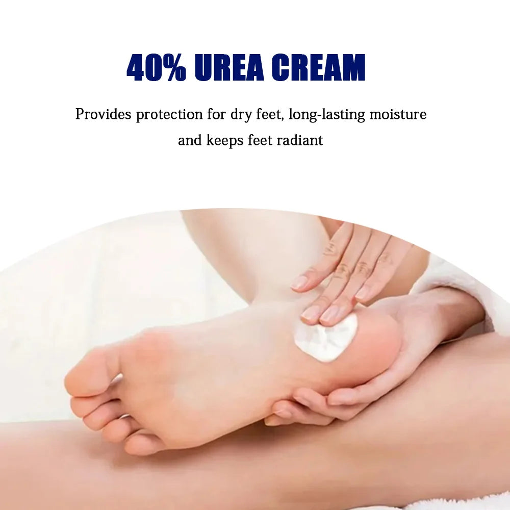 YOUNGCOME 40% Urea & 2% Salicylic Acid Hand & Foot Cream Hand & Foot Cream Qst
