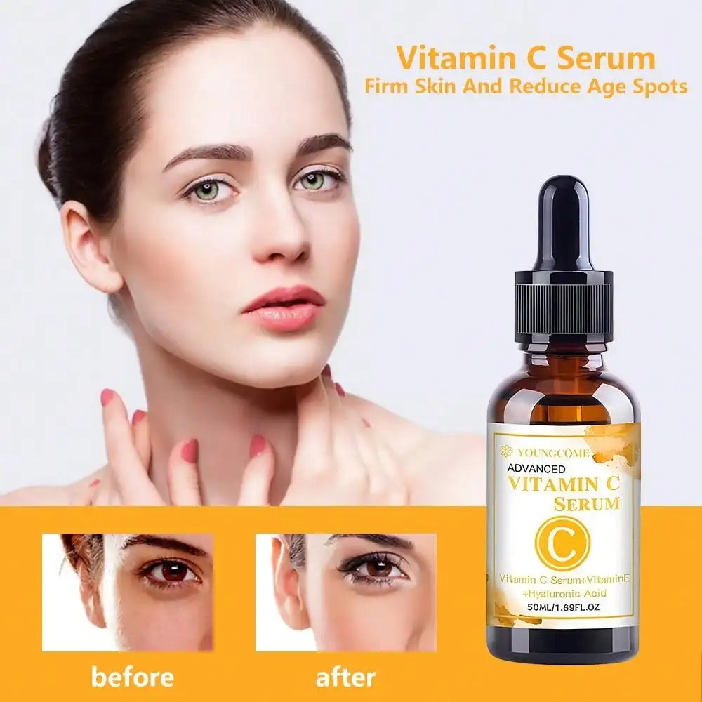 YOUNGCOME Vitamin C Facial Serum 50ml – Hyaluronic Acid Facial Serum Qst