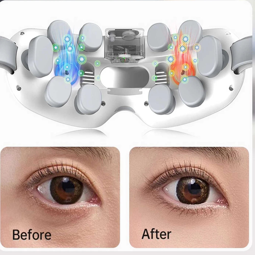 Vilnason Smart Eye Massager – 4 Modes, Vibration & Compress Eye Massager Qst