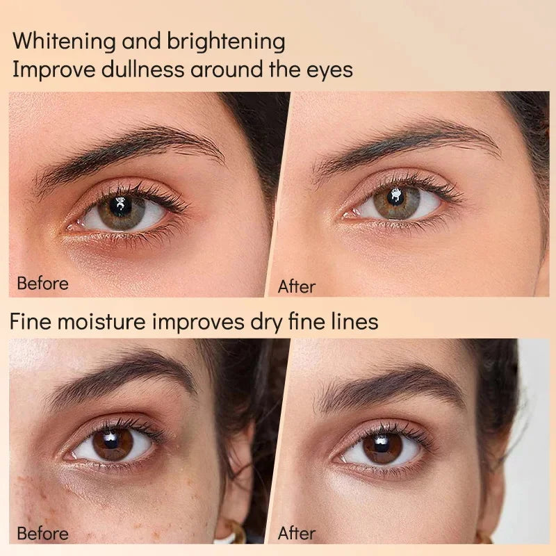 Retinol Eye Serum Roller | Rolling Bead Massage Eye Care Eye Serum Roller Qme