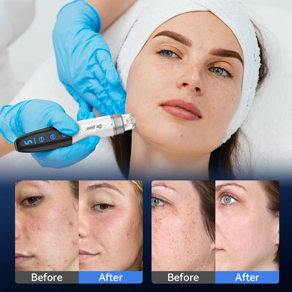 Dr. Pen Q1S + Hello Face M500S EMS Microneedling & LED Mask Kit Microneedling & LED Kit Qst