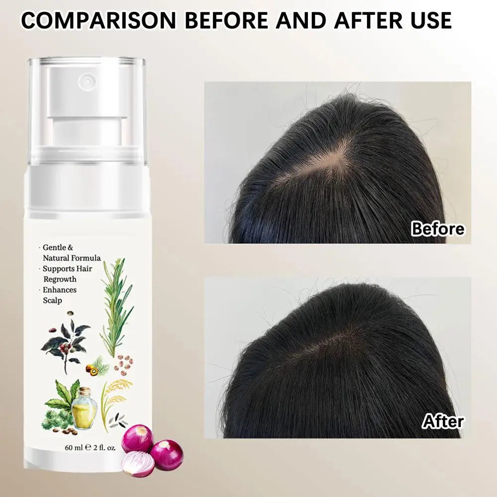 Qme Hair Strengthening Serum – Scalp Nourishing Volume Spray Hair Strengthening Serum Qme