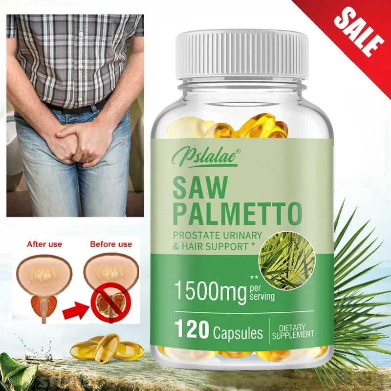 Saw Palmetto Capsules – Prostate, Hair & Vitality Support Herbal Supplement Qst