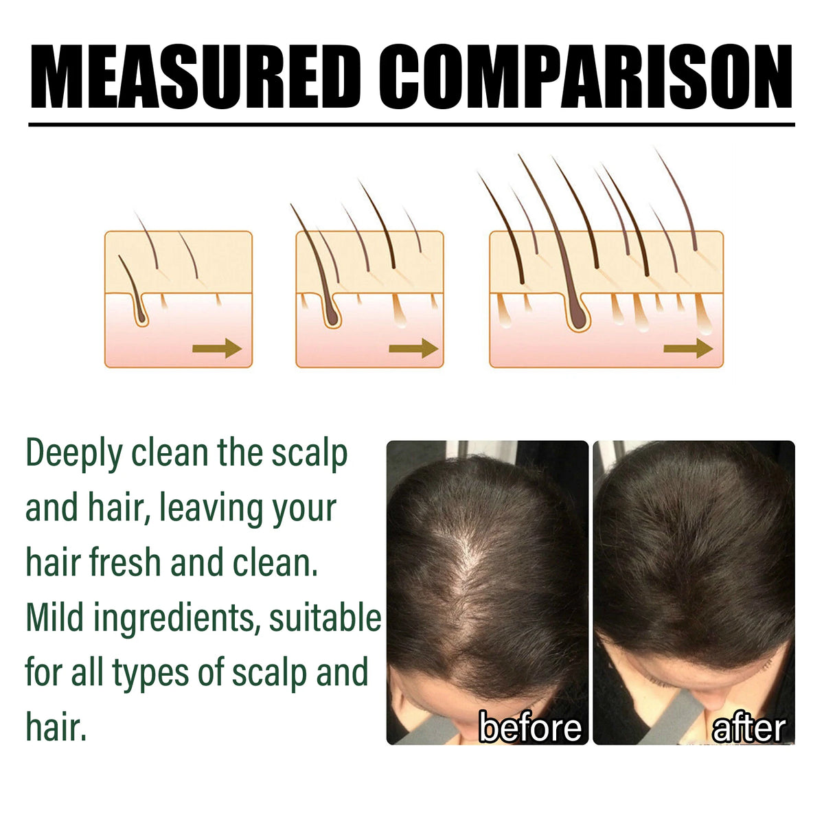 OceAura Amla Oil Shampoo – Volumizing & Strengthening Hair Growth Shampoo Qst