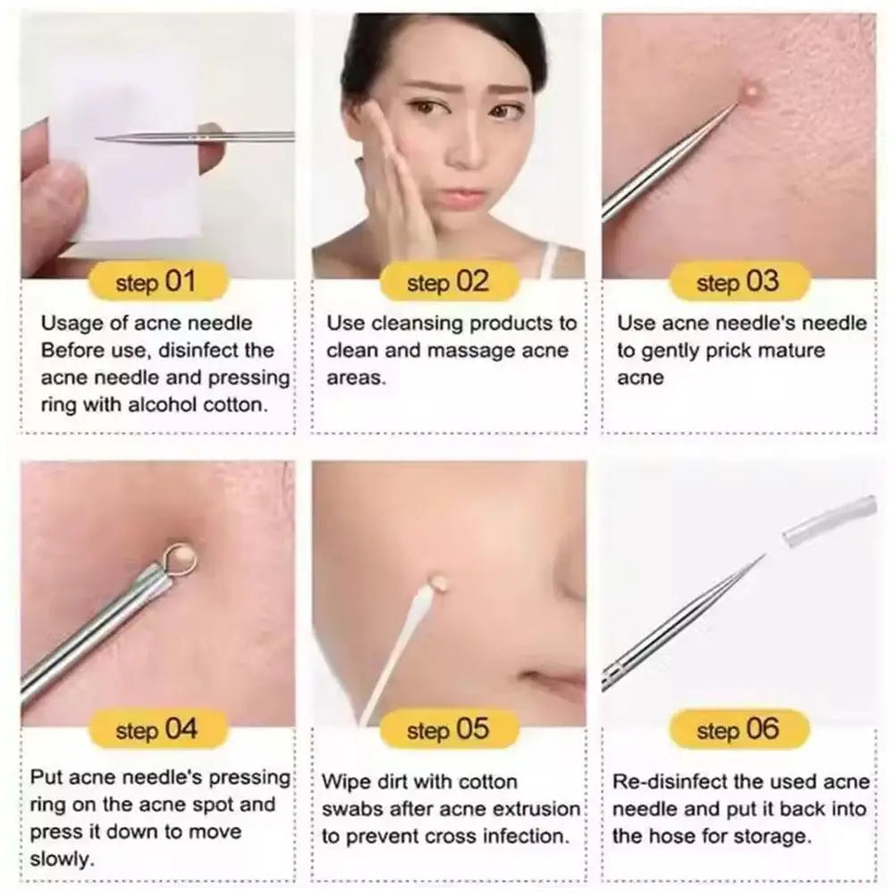 4-Piece Blackhead Remover Tool Set – Curved Tweezers & Needle Blackhead Remover Set Qme