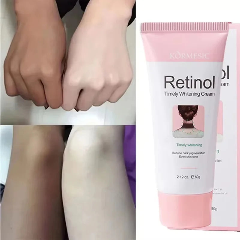 Retinol Brightening Cream – Underarm, Neck & Body Skin Tone Brightening Body Cream Qme