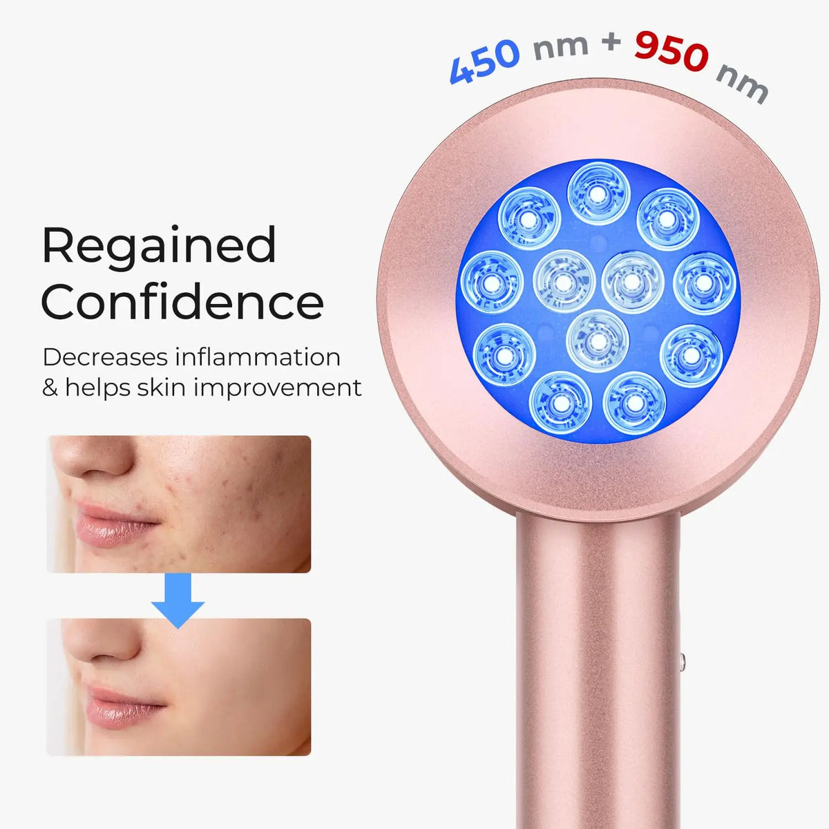 XceeFit Red & Blue Light Therapy LED Skin Care Device LED Skin Care Device Qst