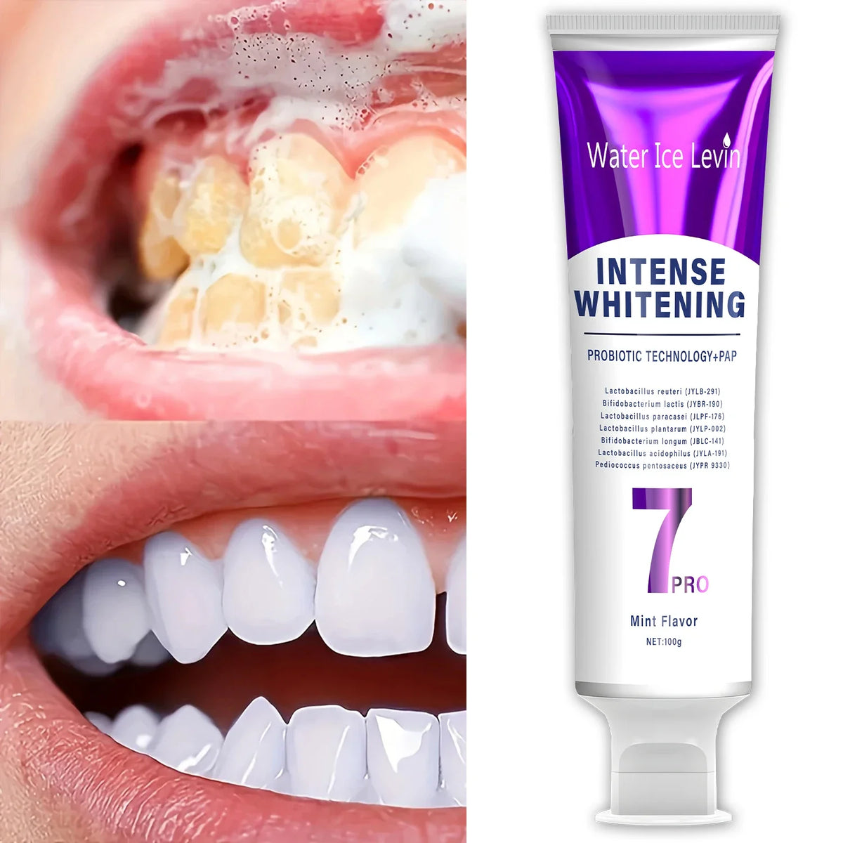 Qme Probiotic Whitening Toothpaste – Fresh Breath & Gum Care Probiotic Toothpaste Qme