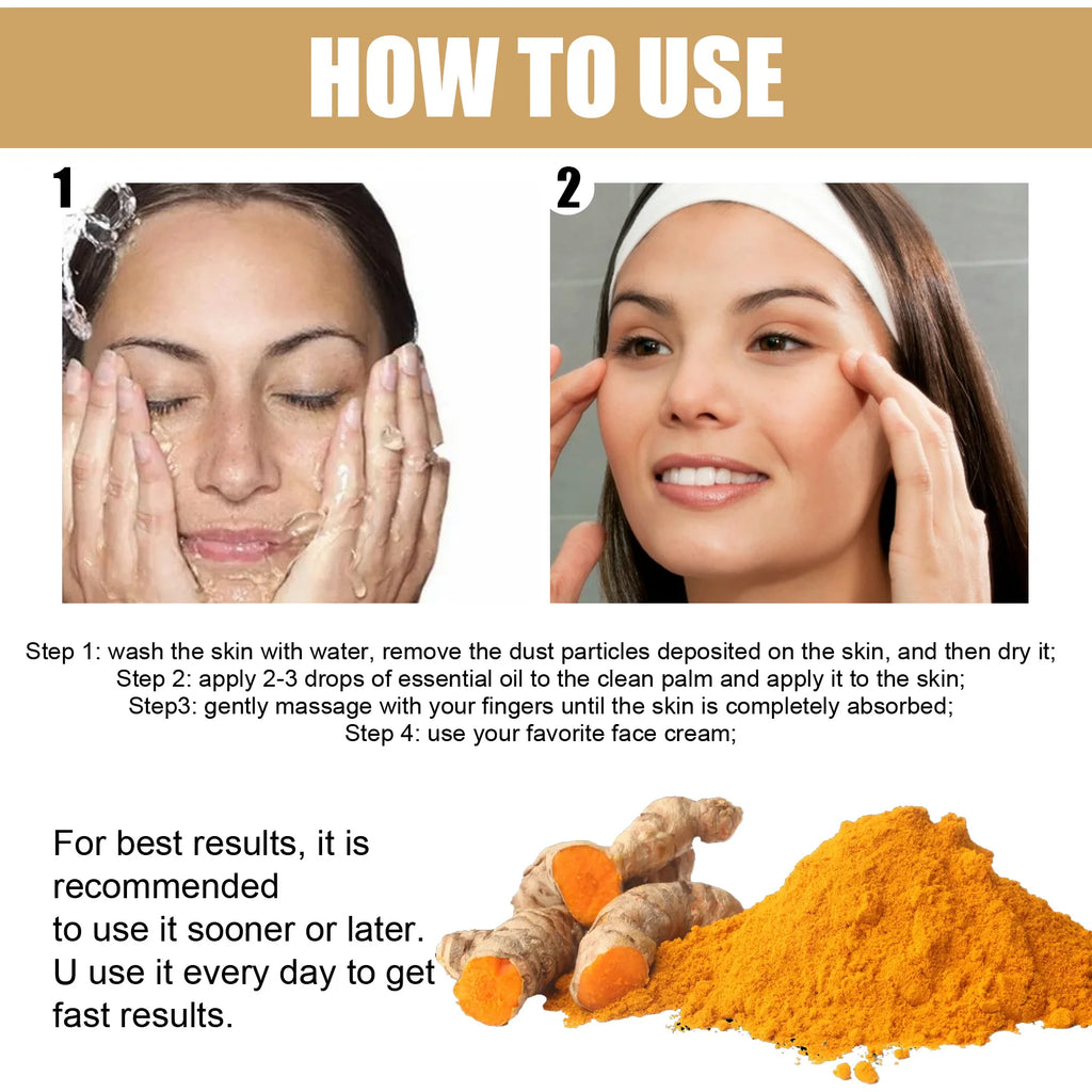Eelhoe Turmeric Brightening Face Serum – Dark Spot & Tone Brightening Face Serum Qst