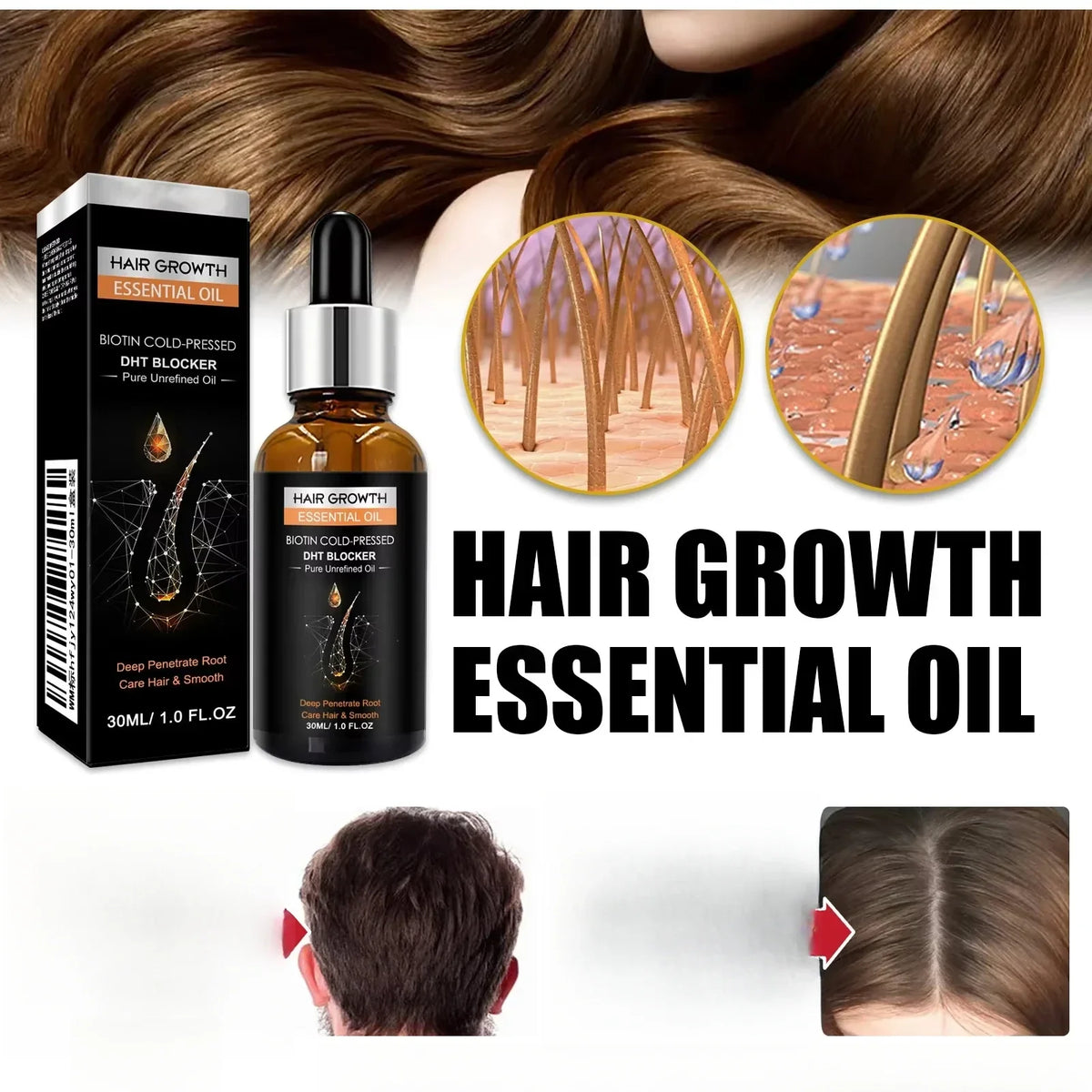 Biotin Hair Growth Oil & DHT Blocking Shampoo Boost | Qme Hair Growth Treatment Qme