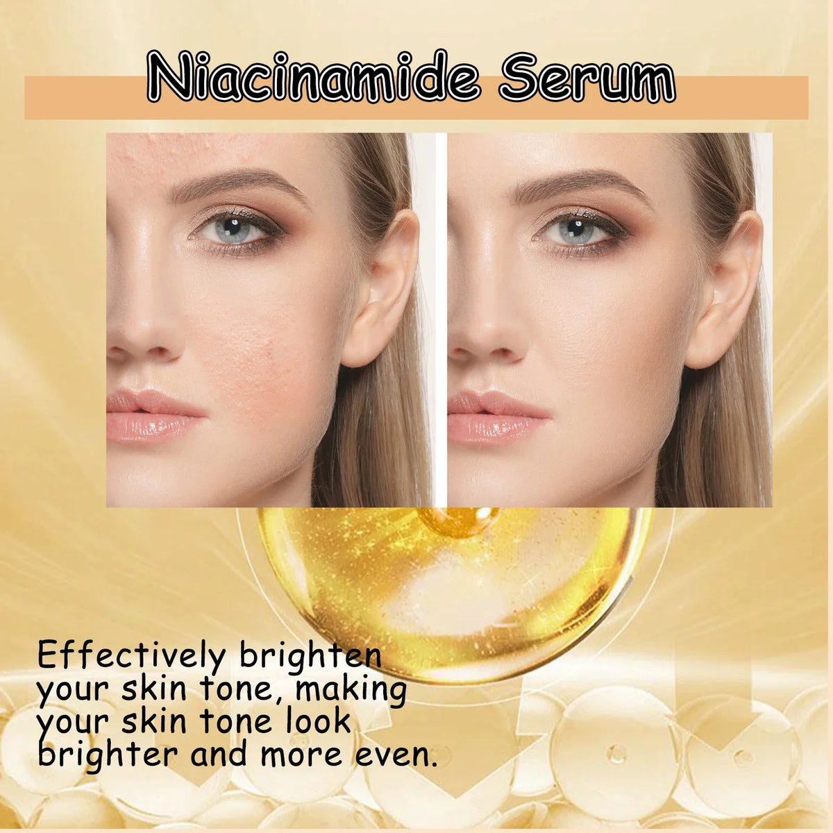 Nicotinamide Face Serum – Brightening & Pore-Smoothing Essence Brightening Face Serum Qme