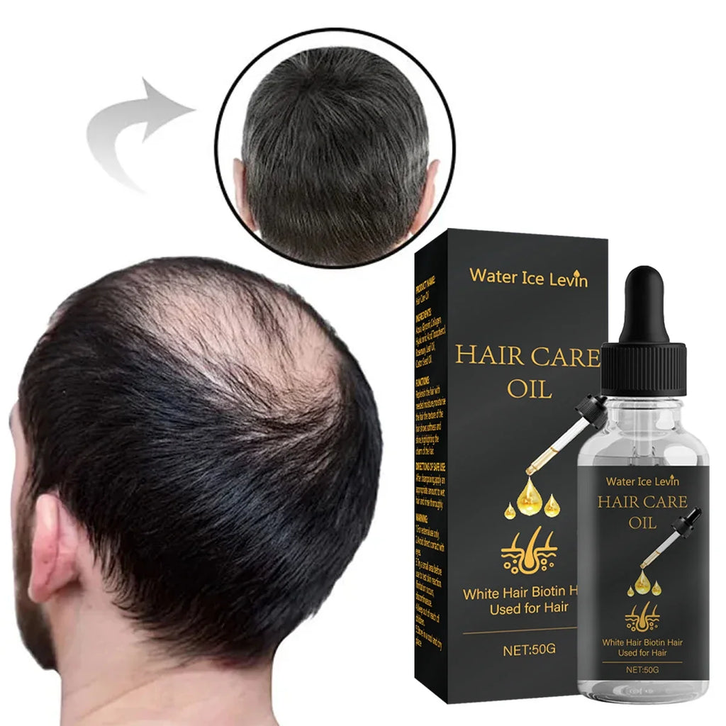 Biotin Hair Care Oil – Rosemary, Castor & Collagen Blend Hair Care Oil Qme