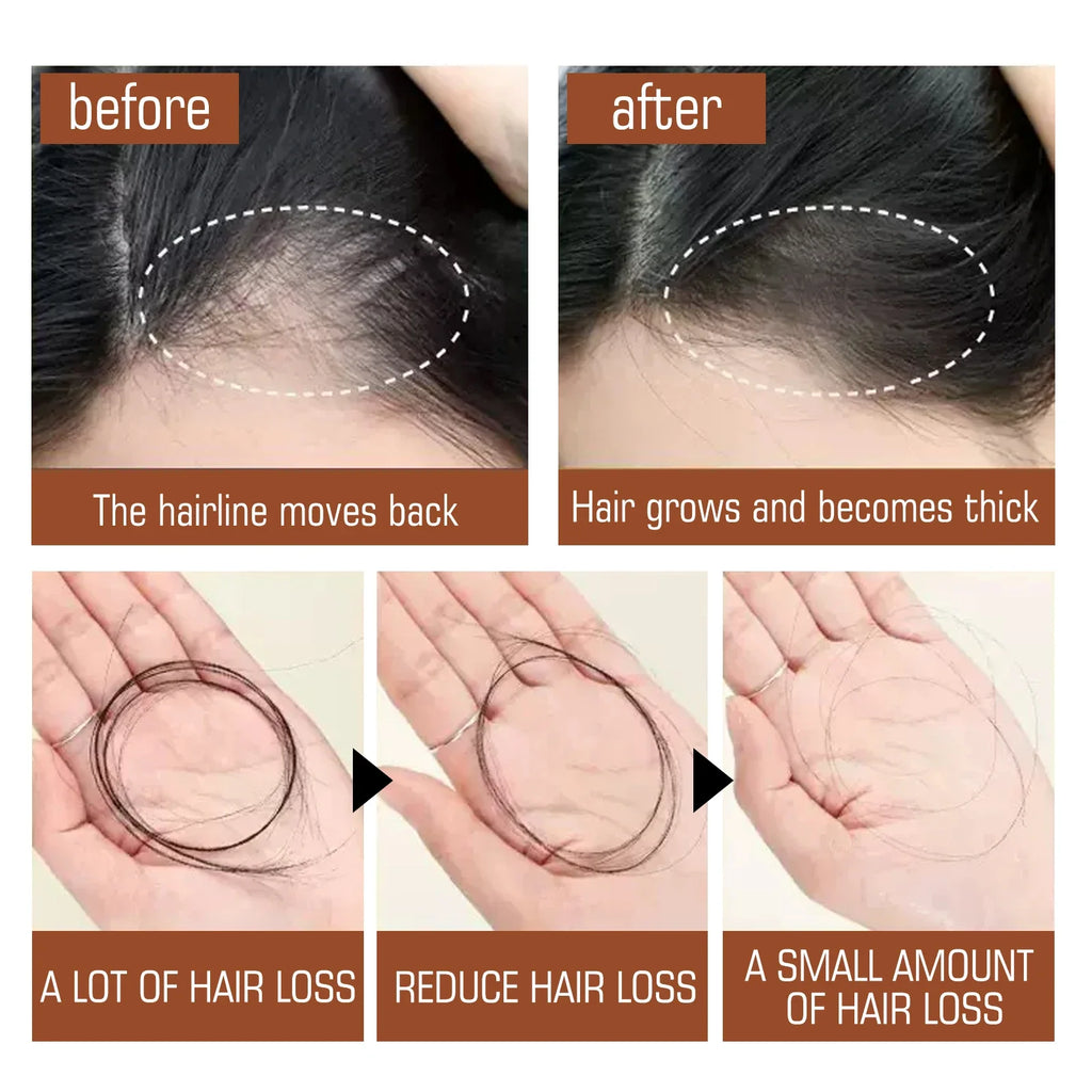 Organic Batana Oil Hair Mask – Natural Nourishing Growth Treatment Organic Hair Mask Qme