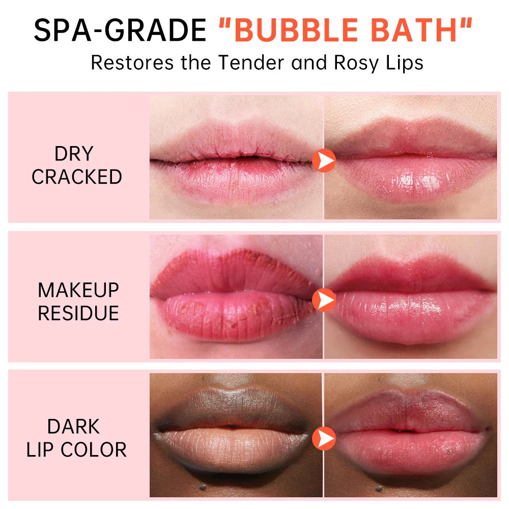 JoyPretty Bubble Lip Mask – Exfoliating & Moisturizing Lip Balm Lip Mask Treatment Qst