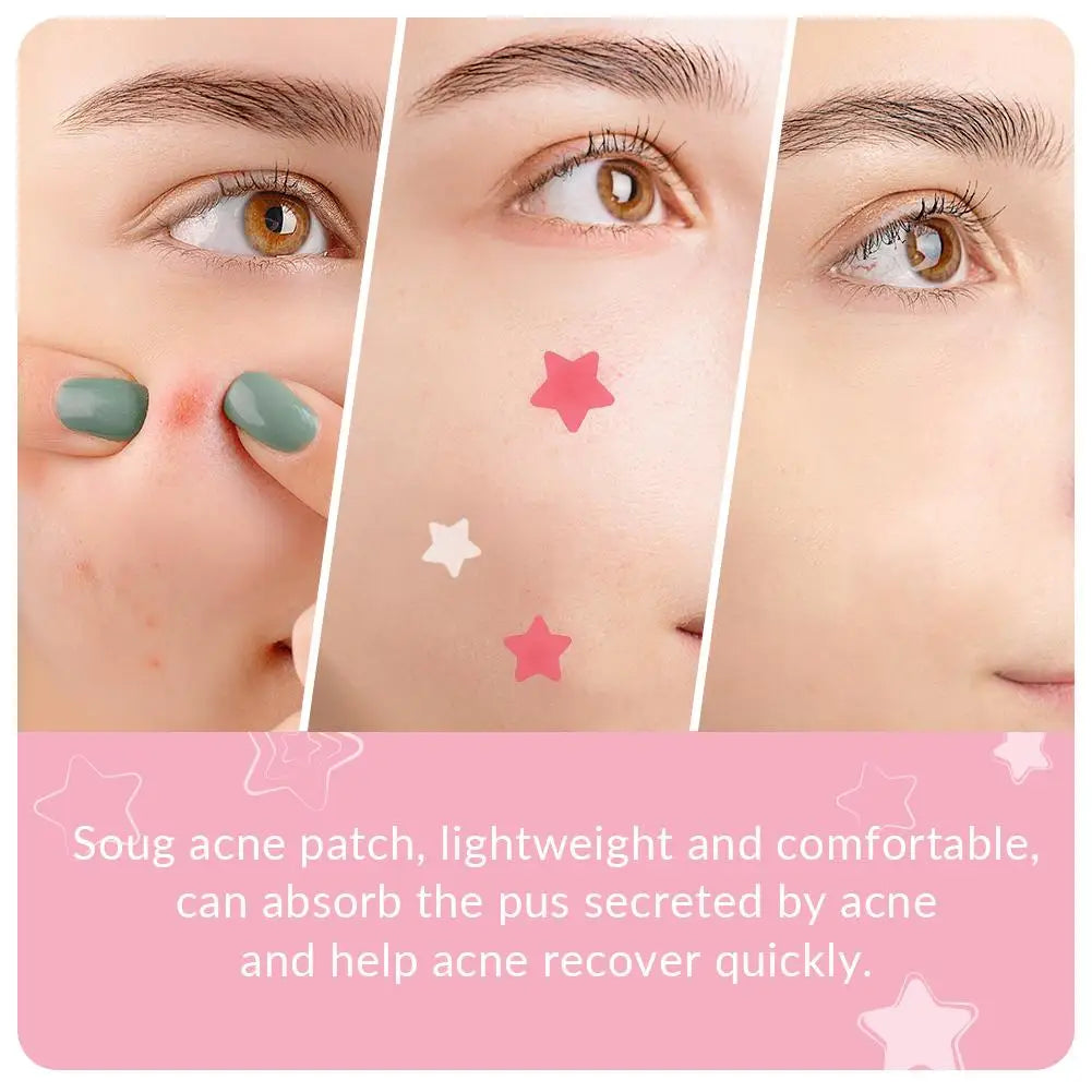 Cute Star Pimple Patches – 240pcs Invisible Spot Cover Pimple Patch Stickers Qme